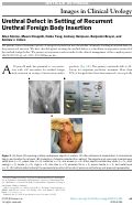 Cover page: Urethral Defect in Setting of Recurrent Urethral Foreign Body Insertion.