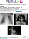 Cover page: Achalasia: An Uncommon Presentation with Classic Imaging