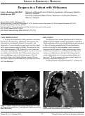 Cover page: Dyspnea in a Patient with Melanoma