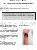 Cover page: Extravasation from a Misplaced Intraosseous Catheter