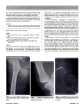 Cover page: Beware the pseudo guinea worm!