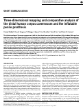 Cover page: Three-dimensional mapping and comparative analysis of the distal human corpus cavernosum and the inflatable penile prosthesis.