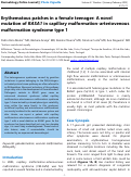 Cover page: Erythematous patches in a female teenager: a novel mutation of RASA1 in capillary malformation-arteriovenous malformation syndrome type 1