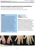 Cover page: Acquired aquagenic papulotranslucent acrokeratoderma