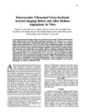 Cover page: Intravascular ultrasound cross-sectional arterial imaging before and after balloon angioplasty in vitro.