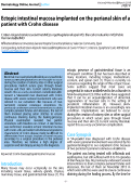 Cover page: Ectopic intestinal mucosa implanted on the perianal skin of a patient with Crohn disease