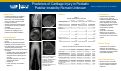 Cover page: Predictors of Cartilage Injury in Pediatric Patellar Instability Remain Unknown