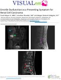 Cover page: Erectile Dysfunction as a Presenting Symptom for Renal Cell Carcinoma