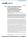 Cover page: Iridocorneal angle imaging of a human donor eye by spectral-domain optical coherence tomography.