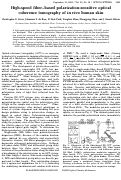 Cover page: High-speed fiber based polarization-sensitive optical coherence tomography of in vivo human skin.