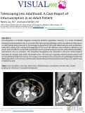 Cover page: Telescoping into Adulthood: A Case Report of Intussusception in an Adult Patient