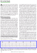 Cover page: ECG of the Month.