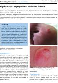 Cover page: Erythematous asymptomatic nodule on the sole