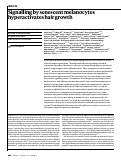 Cover page: Signalling by senescent melanocytes hyperactivates hair growth