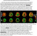 Cover page: Compromised blood brain barrier function in patients with heart failure