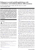 Cover page: Results of Trabectome Surgery Following Failed Glaucoma Tube Shunt Implantation