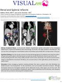 Cover page: Renal and Splenic Infarcts