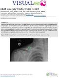 Cover page: Adult Clavicular Fracture Case Report