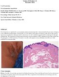 Cover page: Nevus lipomatosus superficialis