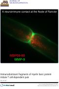 Cover page: Immunodominant fragments of myelin basic protein initiate T cell-dependent pain